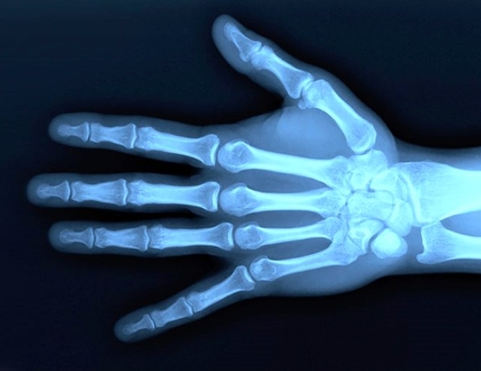 Медицинский центр курорта «Газпром» - ГК «Поляна 1389 Отель и СПА»